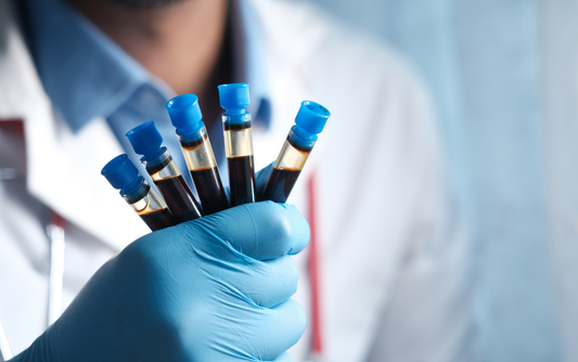 I Feel Healthy. So Why Would I Get Health Testing Now?